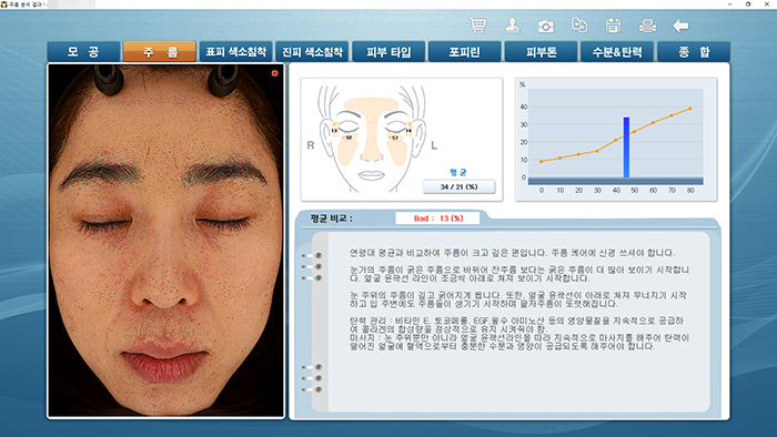 주름