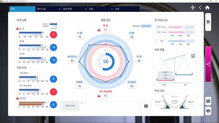 JANUS Pro 고객 피부 분석 종합 결과 화면