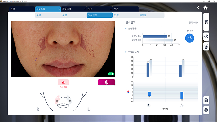 JANUS Pro 팔자 주름 분석 화면