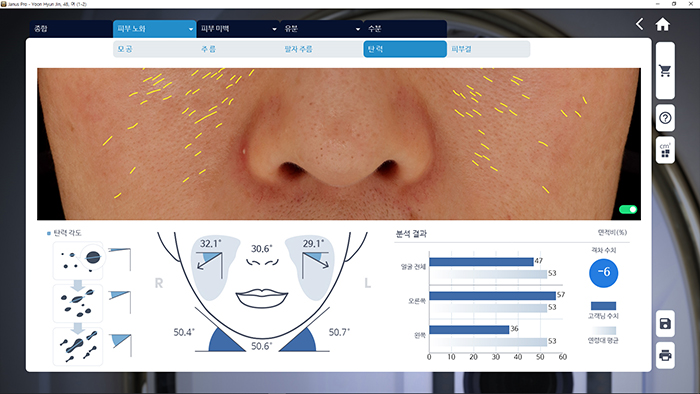 JANUS Pro 피부 탄력 분석 화면