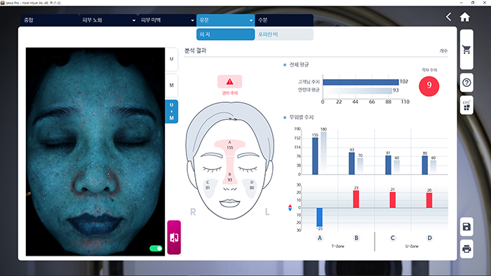 JANUS Pro UV광으로 촬영한 피지 및 포피린 분석화면