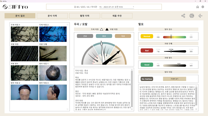 SIF Pro 모발 분석결과 화면